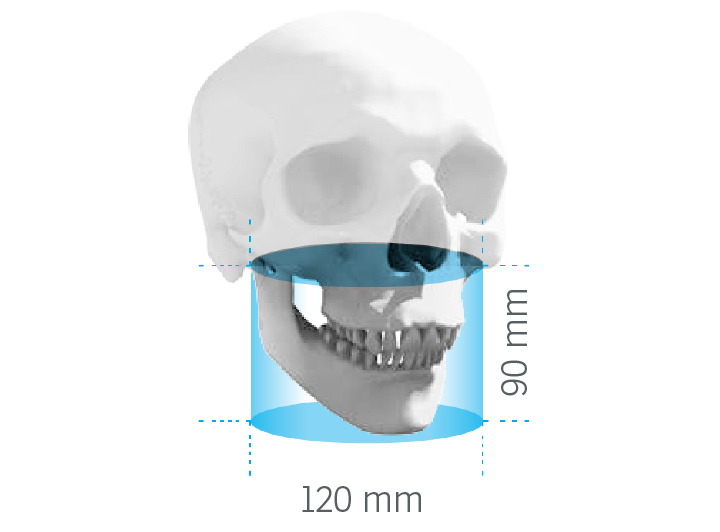 FOV 12x9