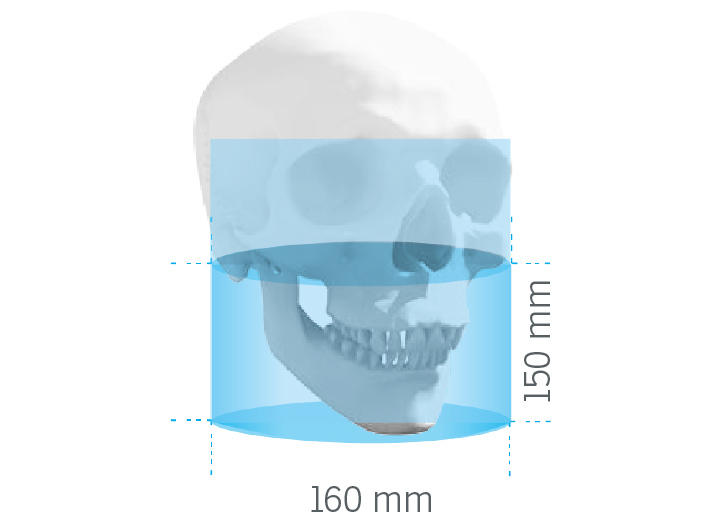 FOV 16x15